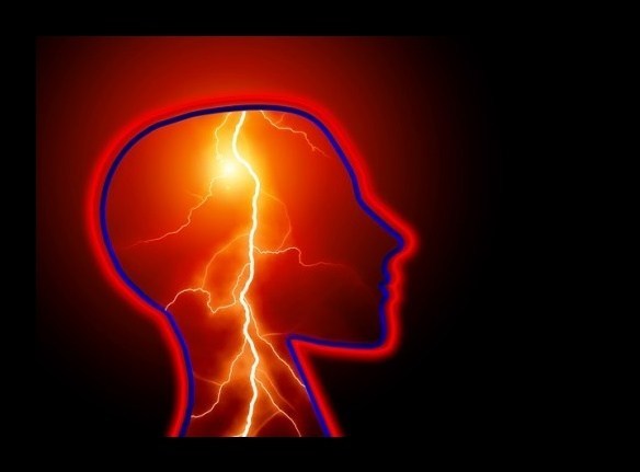 Severe/thunderclap head pain